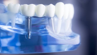 Diş diş diş hekimliği modeli