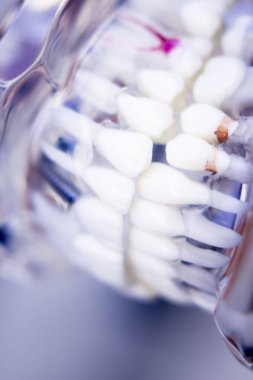 Diş hekimleri diş diş modeli