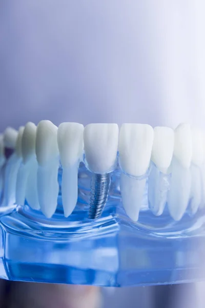 Modello di odontoiatria dentale — Foto Stock