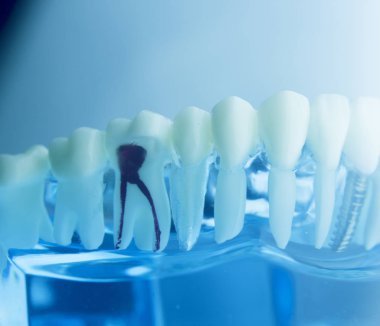 Diş diş diş hekimliği modeli