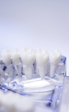 Diş hekimleri diş diş modeli