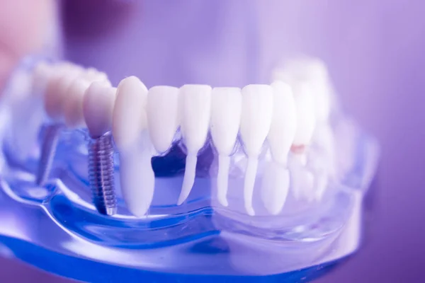 Dentes dentários modelo odontológico — Fotografia de Stock