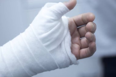 Doktor hasta alçı