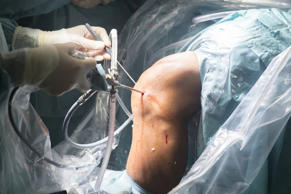 Операция на коленях — стоковое фото