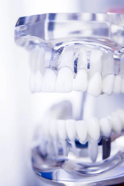 Dentisti modello dentale — Foto Stock