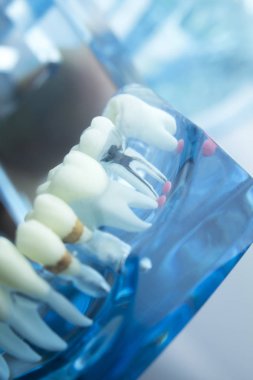 Diş diş diş hekimliği modeli