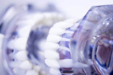 Diş hekimleri diş diş modeli