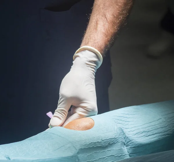 Cirugía de rodilla inyección anestésica —  Fotos de Stock