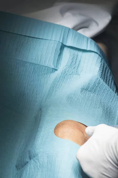 Diz ameliyatı Cerrahi operasyon — Stok fotoğraf