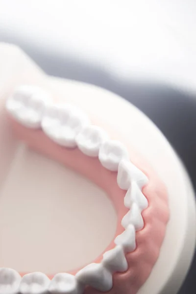 치과 치아 치과 모델 — 스톡 사진