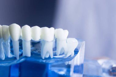 Diş diş diş hekimliği modeli