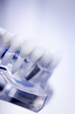 Diş hekimleri diş diş modeli