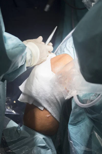 Knie-Operation Krankenschwester Verband — Stockfoto