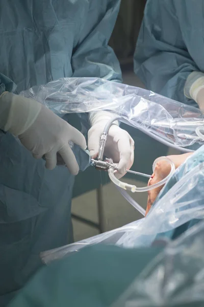 Térd sebészet Kórház működését — Stock Fotó