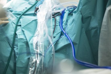 Hastane cerrahi tiyatrodan