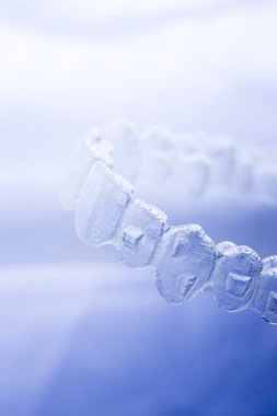 Görünmez aligner Diş telini