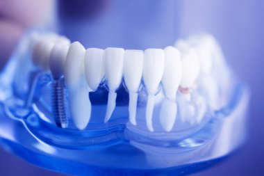 Diş diş diş hekimliği modeli