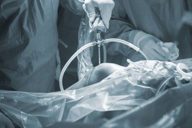 Diz cerrahisi Hastanesi işlemi