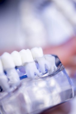 Diş hekimleri diş diş modeli