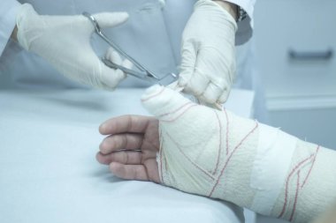 Doktor hasta alçı