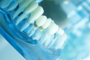 Diş diş diş hekimliği modeli