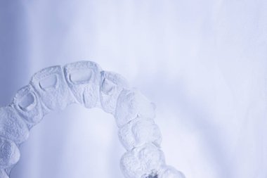 Görünmez aligner Diş telini