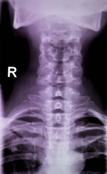 Pescoço da coluna varredura de teste de raios X — Fotografia de Stock