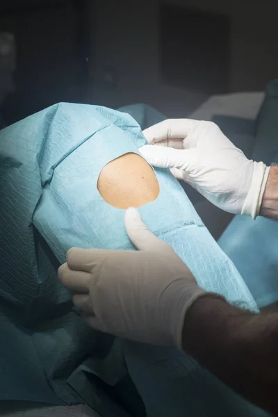 การผ่าตัดหัวเข่า — ภาพถ่ายสต็อก