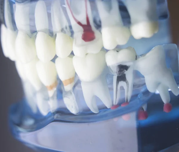 Modello di odontoiatria dentale — Foto Stock