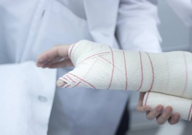 Doktor hasta alçı