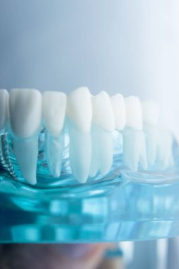 Diş diş diş hekimliği modeli