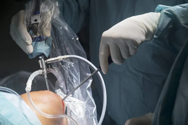 Knie-Operation im Krankenhaus — Stockfoto