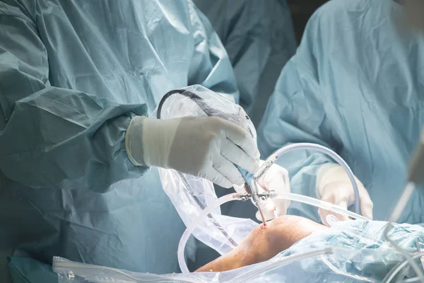 Chirurgia del ginocchio operazione in ospedale — Foto Stock