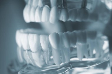 Diş diş diş hekimliği modeli