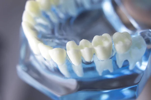 Модель стоматологии зубов — стоковое фото