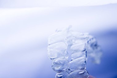 Görünmez aligners diş hizmetli