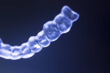 Görünmez diş parantez aligners