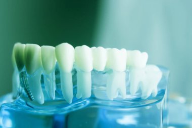 Diş diş diş hekimliği modeli