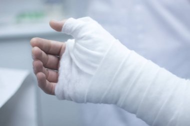 Doktor hasta alçı