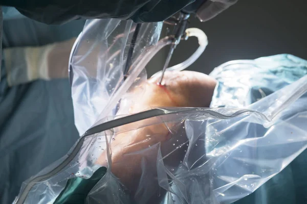 Cirugía de rodilla operación hospitalaria —  Fotos de Stock