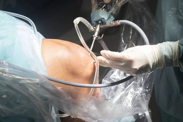 Операция на коленях — стоковое фото
