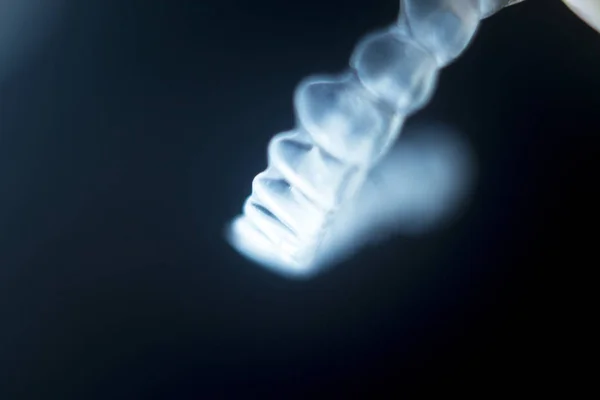 Невидимые скобки для зубов — стоковое фото