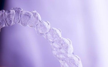 Görünmez aligners diş hizmetli