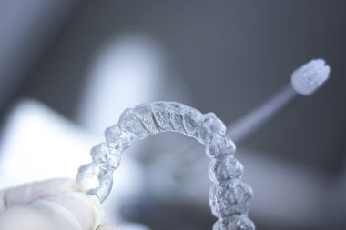 Görünmez diş aligner parantez