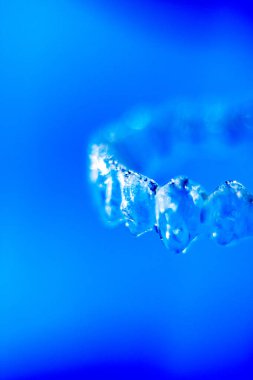 Görünmez diş aligner parantez