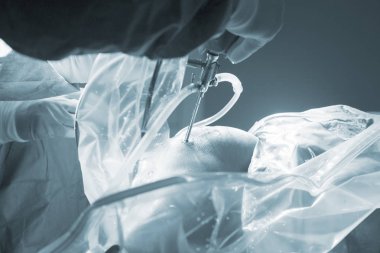 Diz cerrahisi Hastanesi işlemi