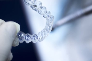 Görünmez diş aligner parantez