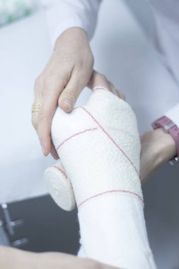 Doktor hasta alçı