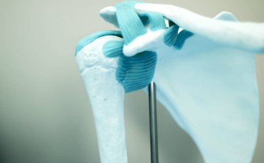 Omuz geri tıp modeli