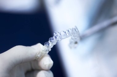 Görünmez diş aligner parantez
